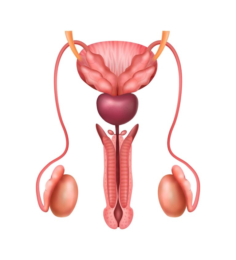 Urethral Stricture