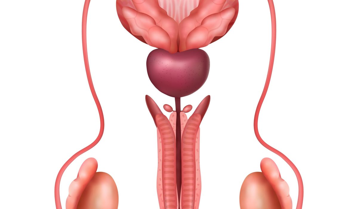 Urethral Stricture